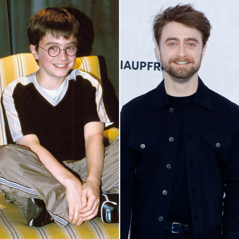   Daniel Radcliffe Qua Năm Tháng