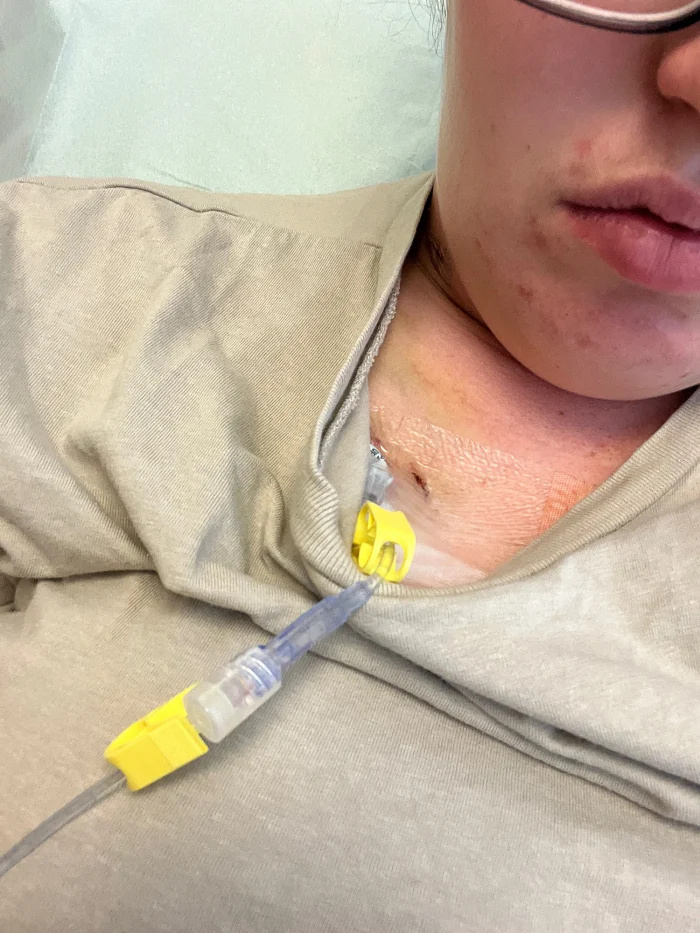 Anna'Chickedee' Cardwell Shows Hair Loss After Revealing Stage 4 Cancer Diagnosis