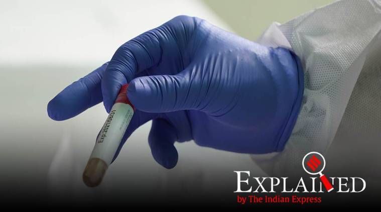 Explicado: Cómo las pruebas rápidas de antígenos detectan Covid-19, donde se usarán en India