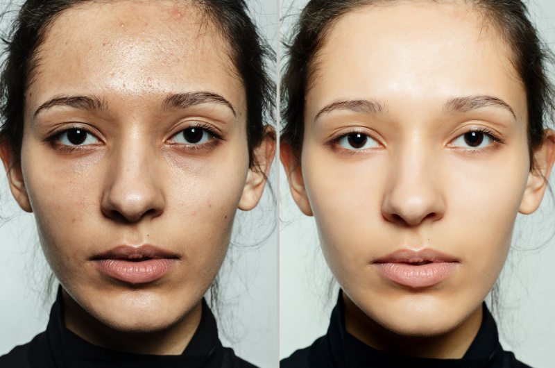Skin-Close-Up-Vorher-Nachher-Shot-Stock-Foto
