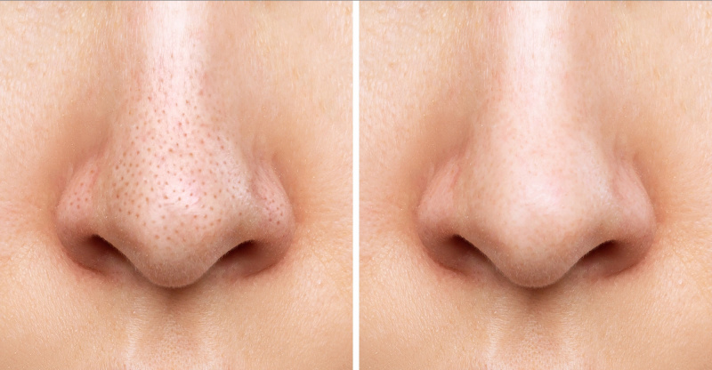 bioderma-crema-refinadora-de-poros