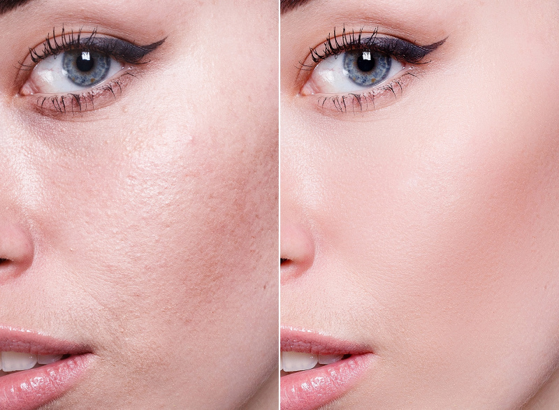 amazon-vichy-double-glow-peel-maska