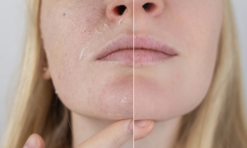   gommage-visage-ultra-fin-amazon-la-roche-posay